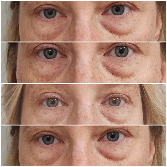 Youthful Eyes at Curve Love, LLC in Greenfield, OH